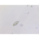 Rotifers